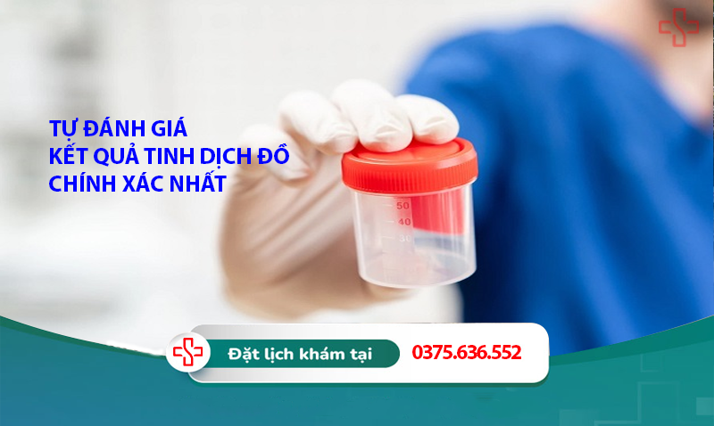 Tự đánh giá kết quả tinh dịch đồ