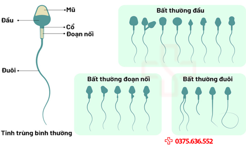 Tự đánh gái kết quả tinh dịch đồ