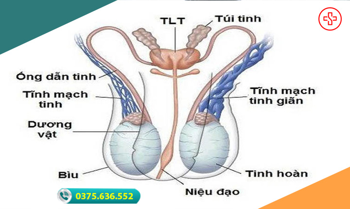 phân đoạn giãn mạch thừng tinh