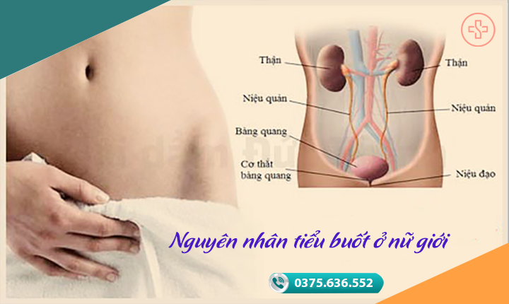nguyên nhân tiểu buốt ở nữ giới