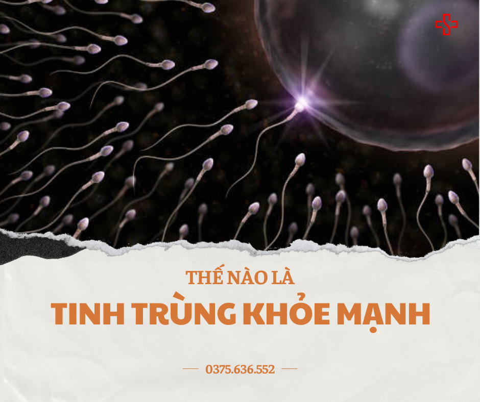 Thế nào là Tinh trùng khỏe mạnh Tinh trùng khỏe mạnh